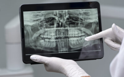 Dental X-Rays in Windsor: Why They’re Important for Your Oral Health
