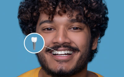 Dentures vs Dental Implants in Windsor: Which Option Is Right for You?